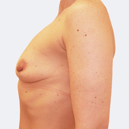 Image before