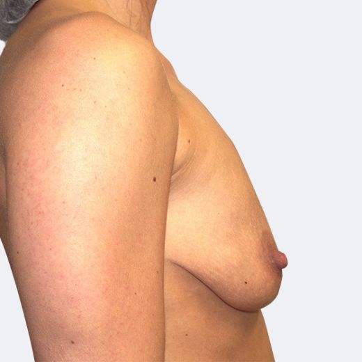 Image before