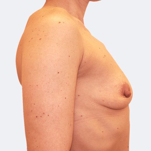 Image before