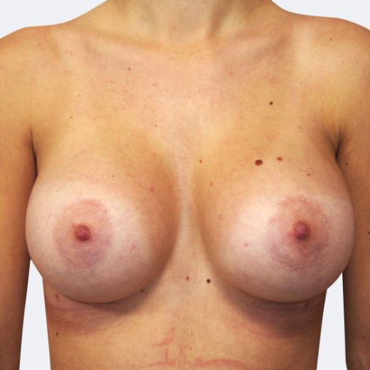 Image after