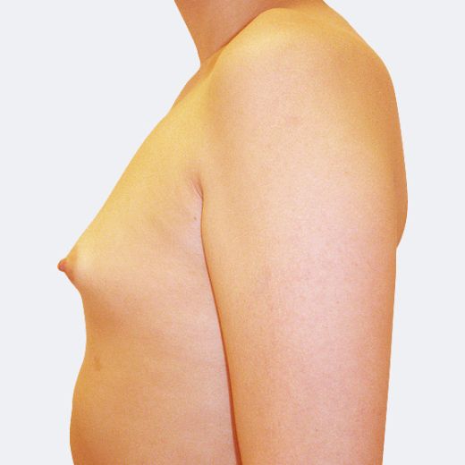 Image before