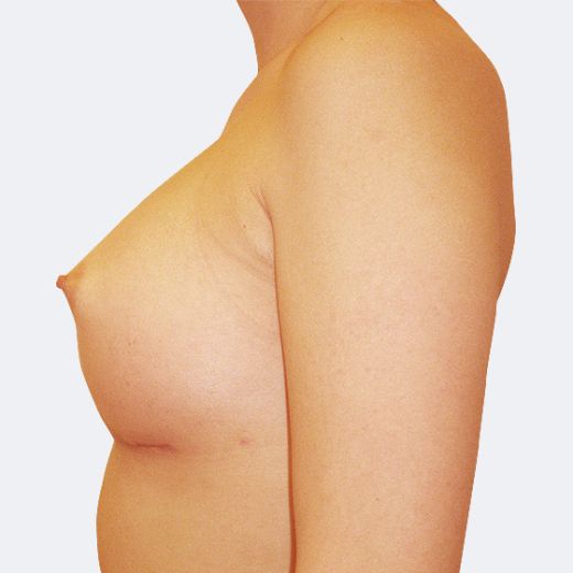 Image after