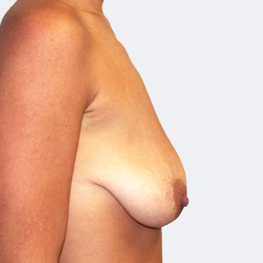 Image before