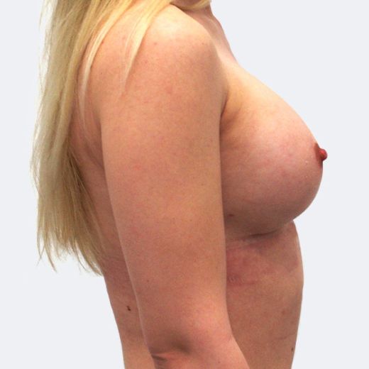 Image after