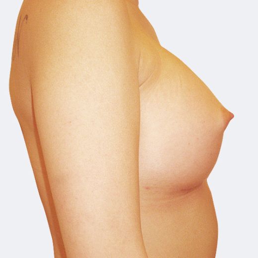 Image after