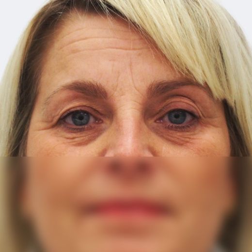 Image before