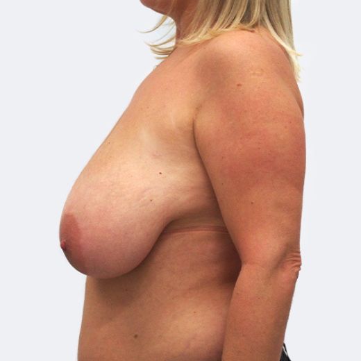 Image before