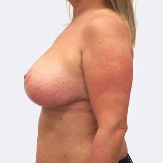 Image after