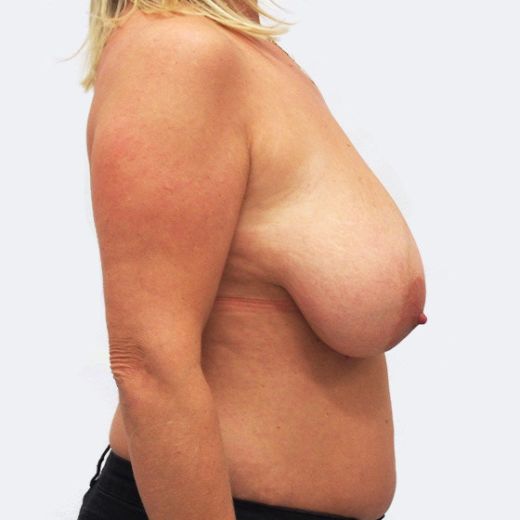 Image before