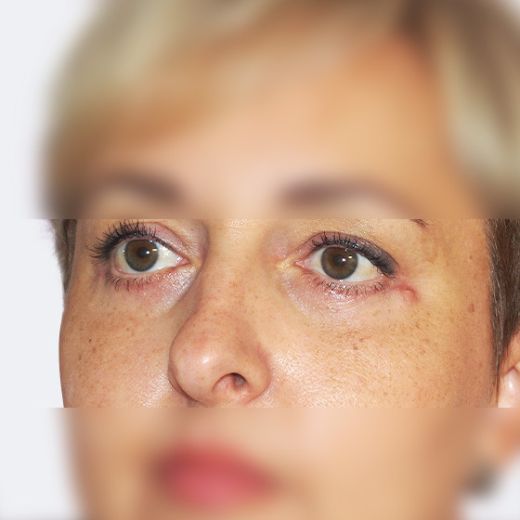 Image after