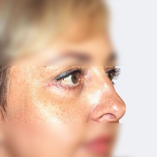 Image after