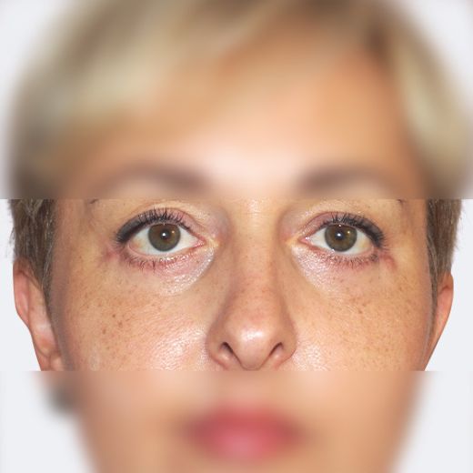 Image after