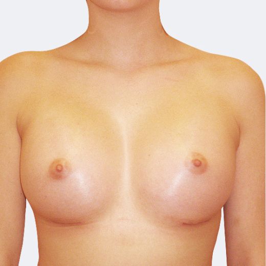 Image after