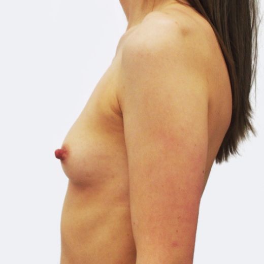 Image before