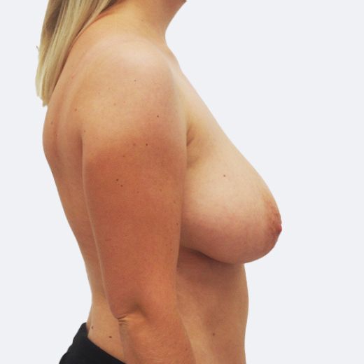 Image before