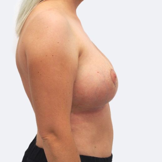Image after