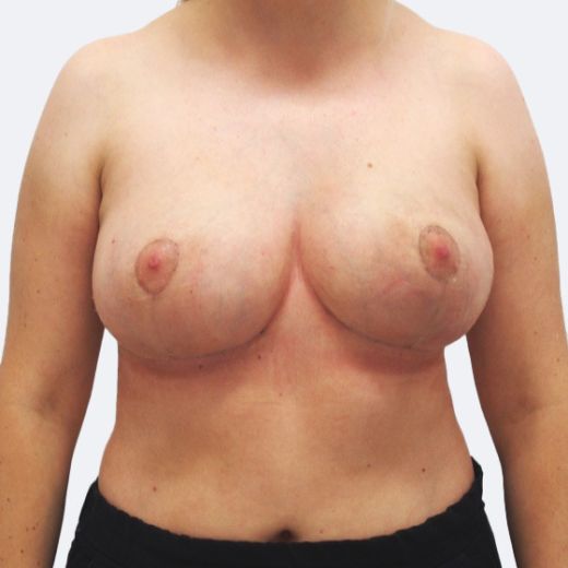 Image after