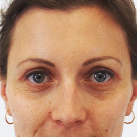 Image after