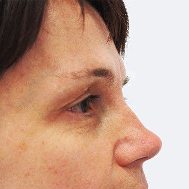 Image before
