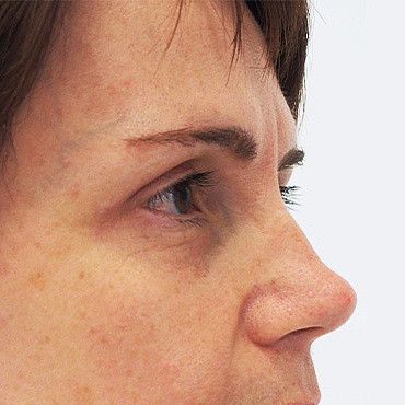 Image after