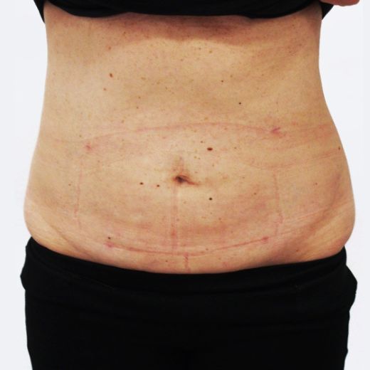 Image after