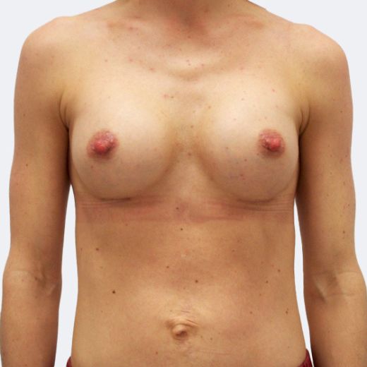 Image after