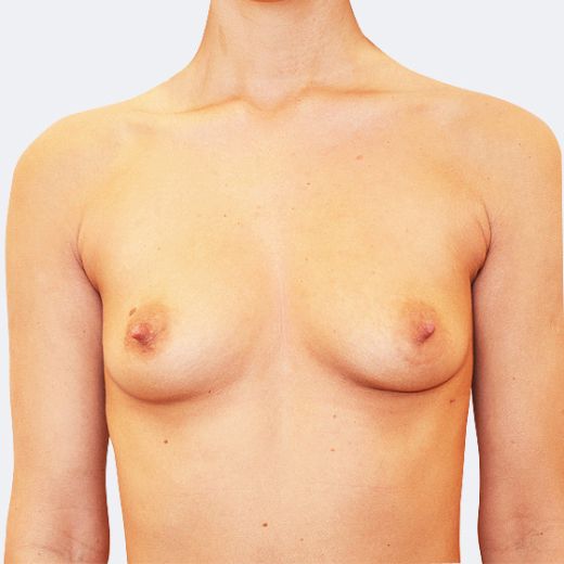 Image before