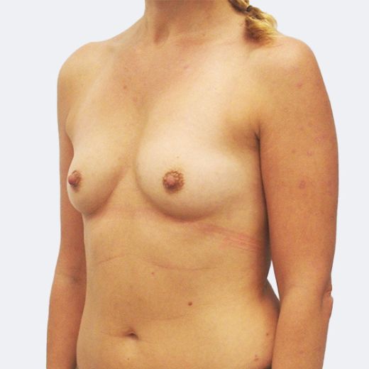 Image before