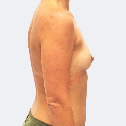 Image before