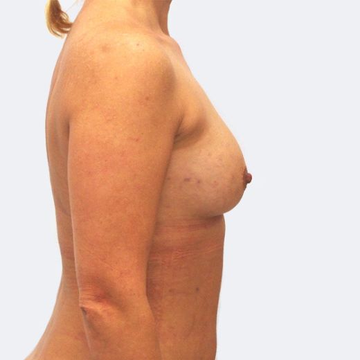 Image after