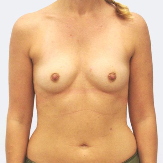 Image before