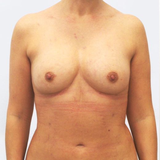 Image after