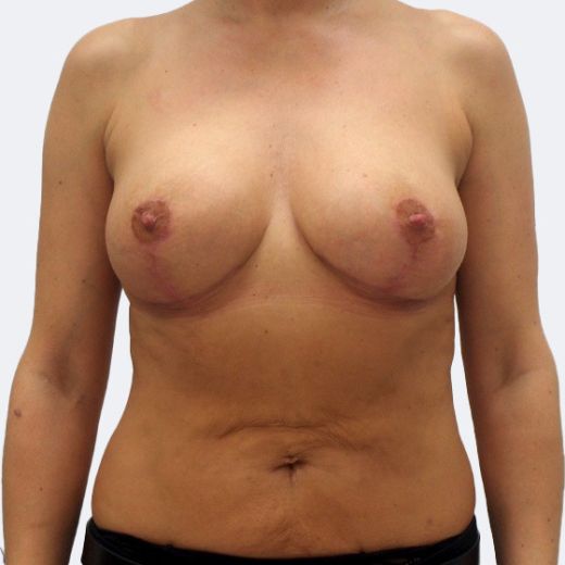 Image after