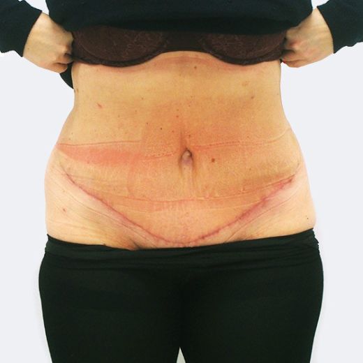 Image after