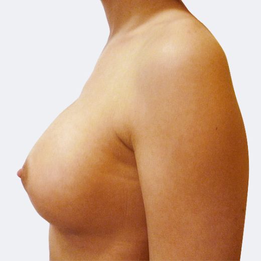Image after