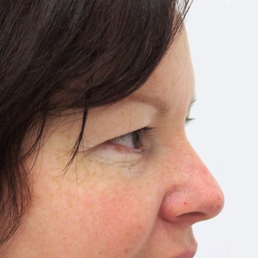 Image before