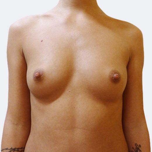 Image before