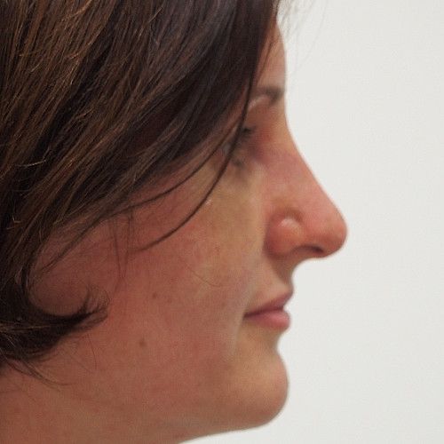 Image after