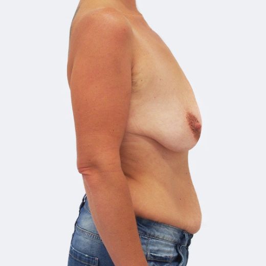 Image before