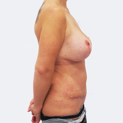 Image after