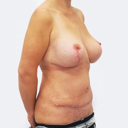 Image after