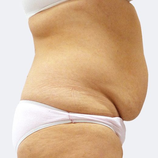 Image before