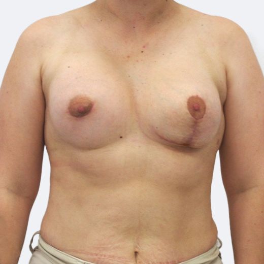Image after