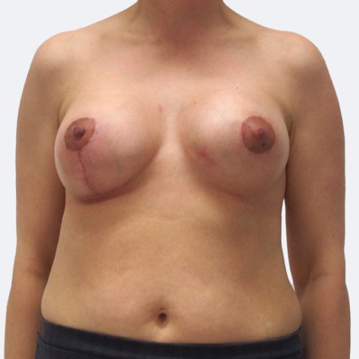 Image after