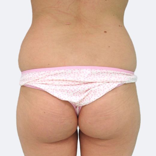 Image before
