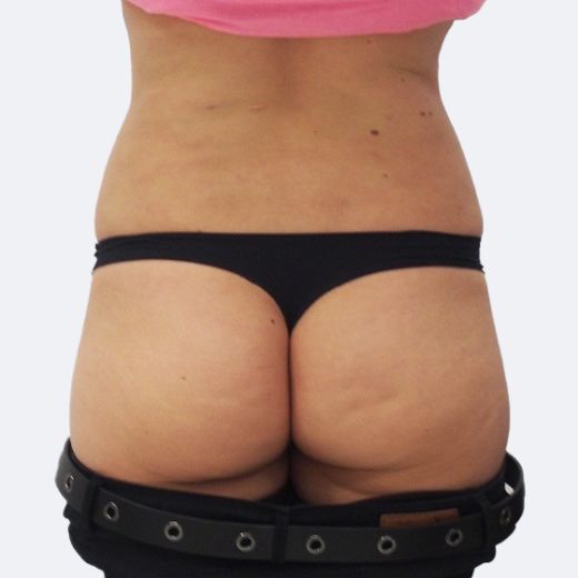 Image after