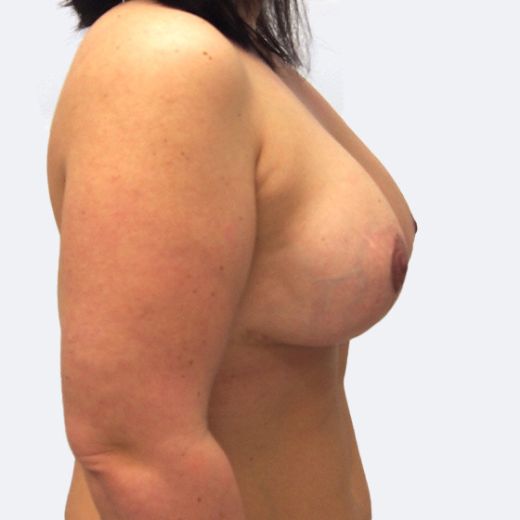 Image after