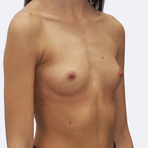 Image before