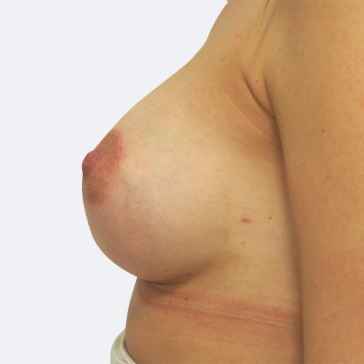 Image after