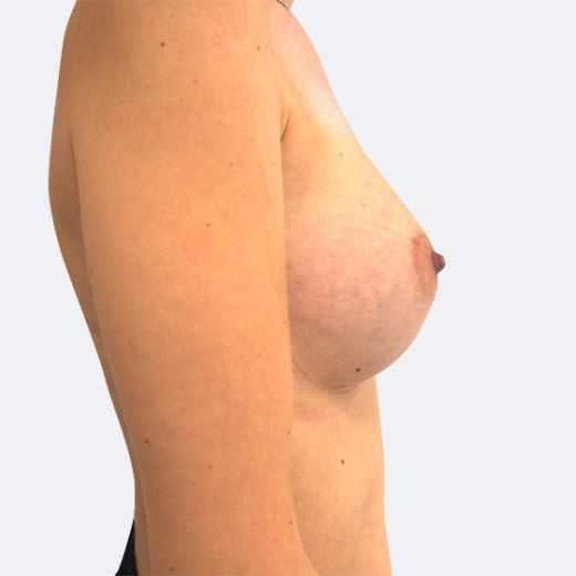 Image after